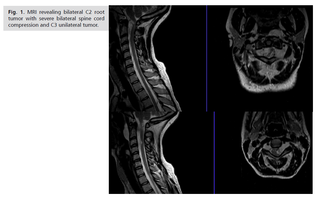 neurology-neuroscience-bilateral-spine