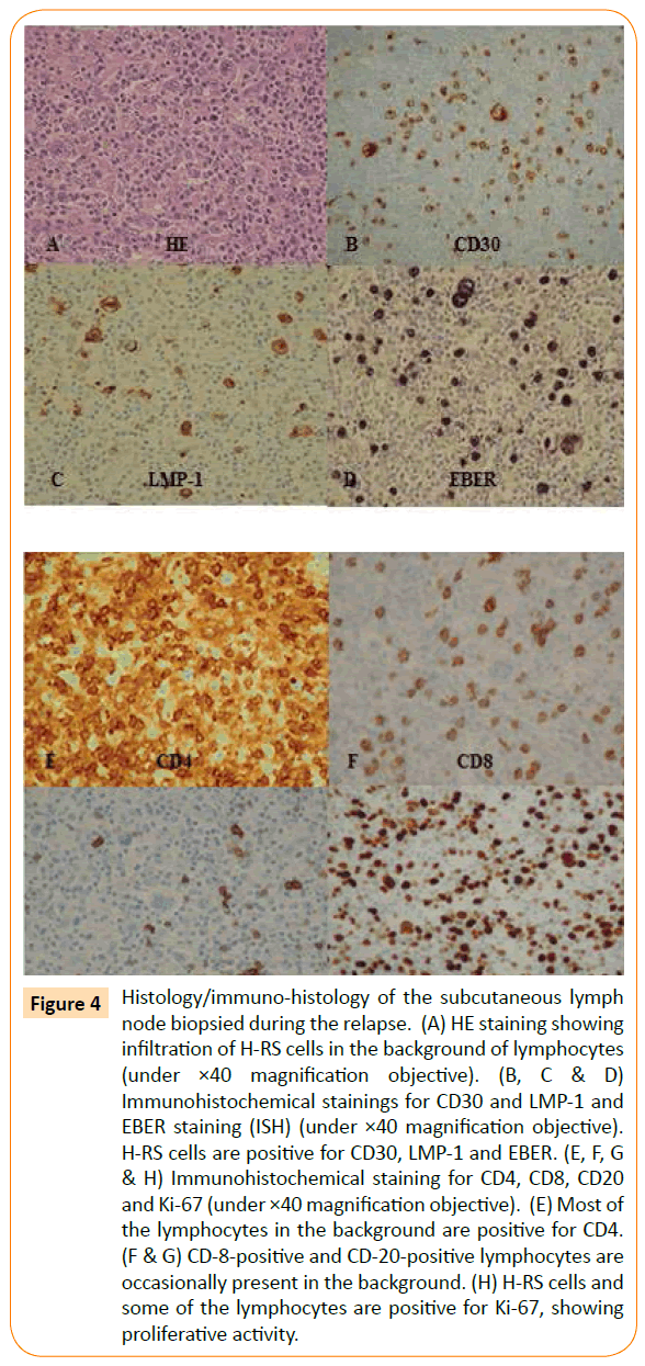 Archives-Clinical-Microbiology-positive-lymphocytes