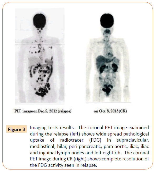 Archives-Clinical-Microbiology-shows-wide-spread