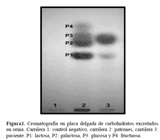 Archivos-de-Medicina-carbohidratos-excretados