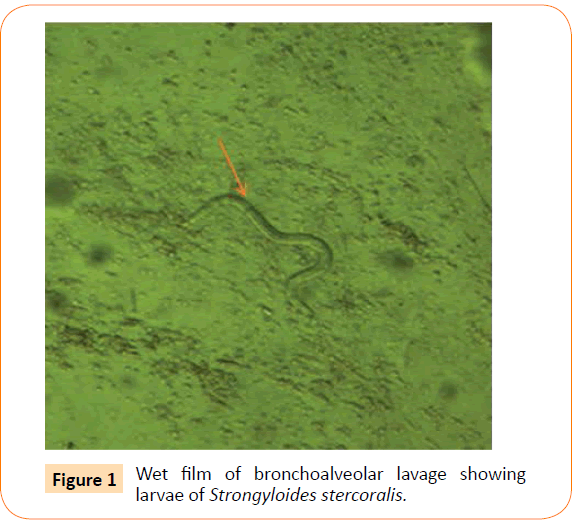 Clinical-Microbiology-lavage-showing