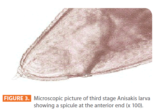 Clinical-Microbiology-stage-Anisakis