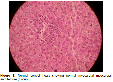 Drug-Development-Research-Normal-control-heart