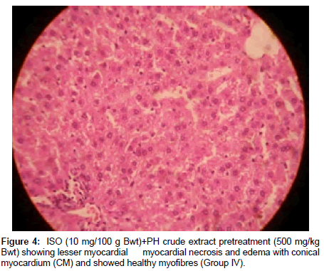 Drug-Development-Research-lesser-myocardial