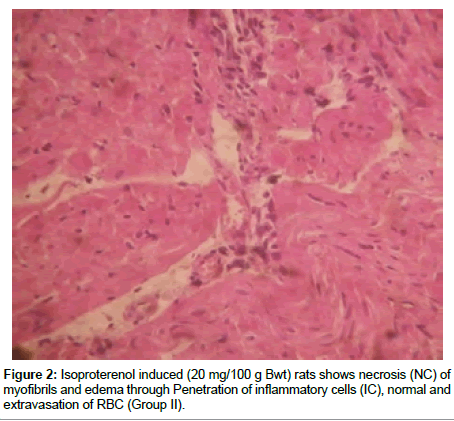 Drug-Development-Research-myofibrils-edema