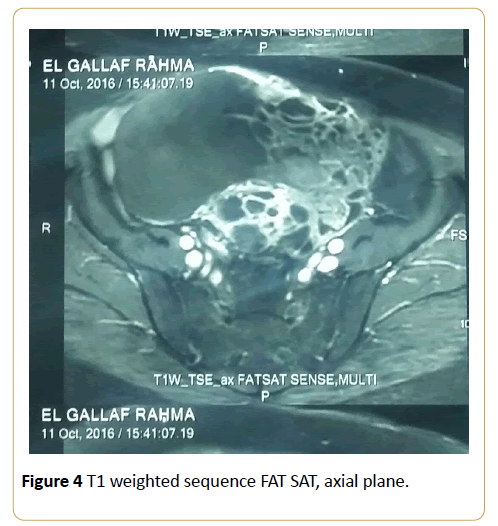 acanceresearch-weighted-sequence-FAT