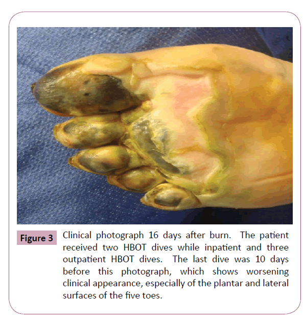 annals-clinical-laboratory-16-days-after