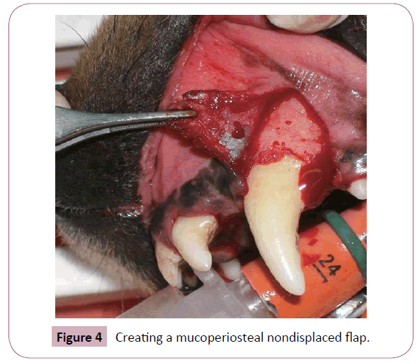 annals-clinical-laboratory-nondisplaced-flap