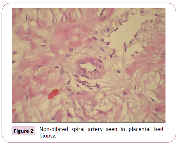 annals-clinical-laboratory-research-non-dilated