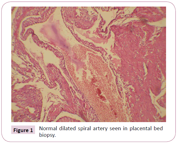 annals-clinical-laboratory-research-placental-bed