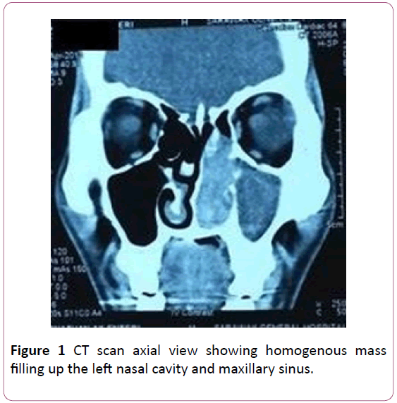 annals-clinical-laboratory-research-scan-axial-view