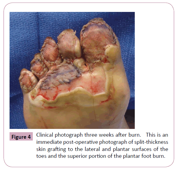 annals-clinical-laboratory-three-weeks-after