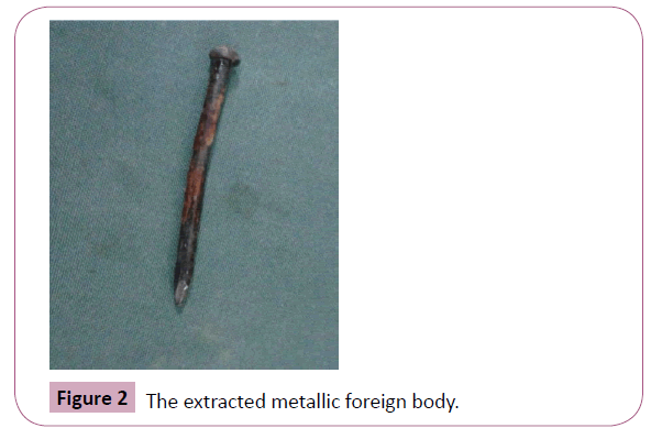 annals-clinical-metallic-foreign-body