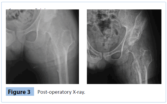 archivesofmedicine-Post-operatory-X-ray