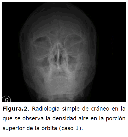 archivosdemedicina-densidad-aire