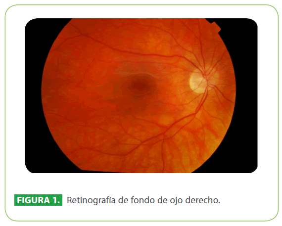 archivosdemedicina-ojo-derecho