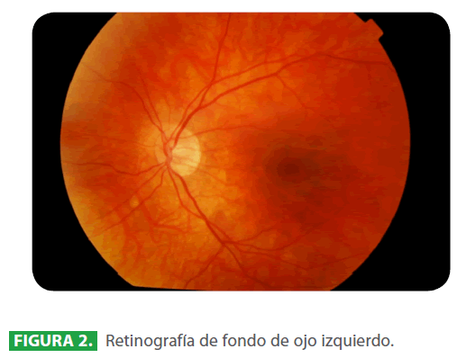 archivosdemedicina-ojo-izquierdo