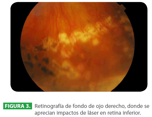 archivosdemedicina-retina-inferior