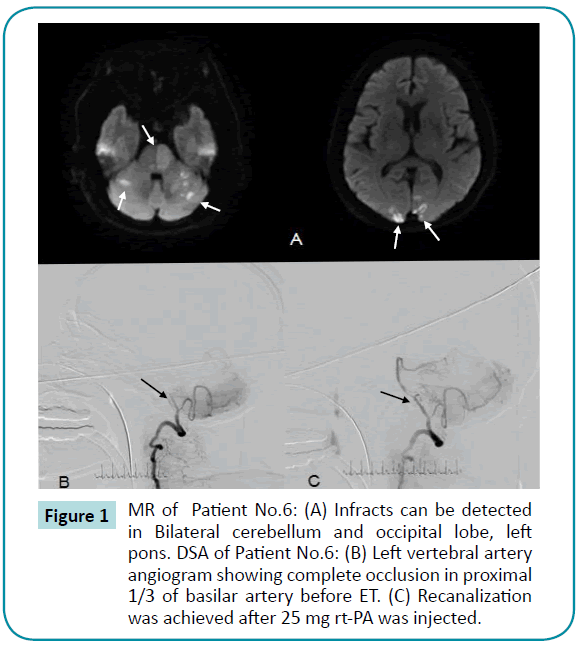 biomedical-sciences-Bilateral-cerebellum