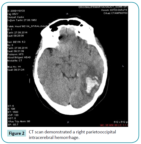 biomedical-sciences-CT-scan-demonstrated