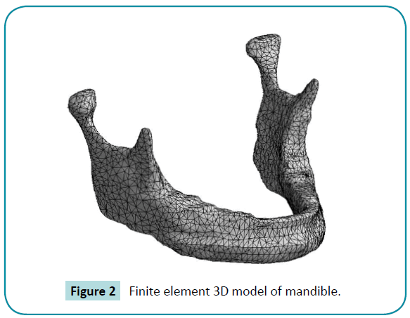 biomedical-sciences-Finite-element