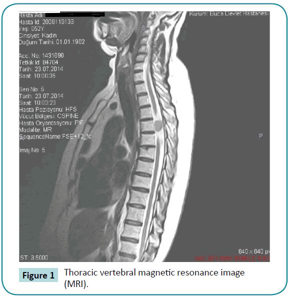 biomedical-sciences-Thoracic-vertebral