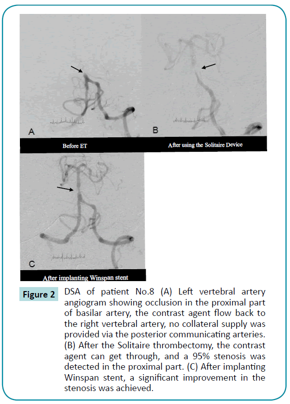 biomedical-sciences-basilar-artery