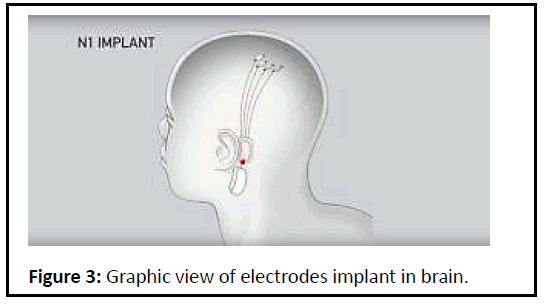 biomedical-sciences-electrode