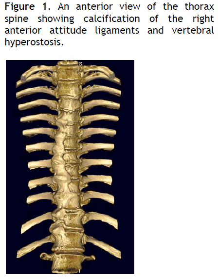 hsj-an-anterior-view-thorax