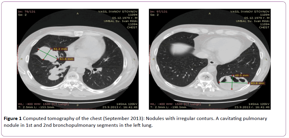 jneuro-Computed-tomography-chest