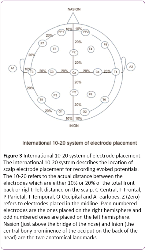 jneuro-International-electrode-placement