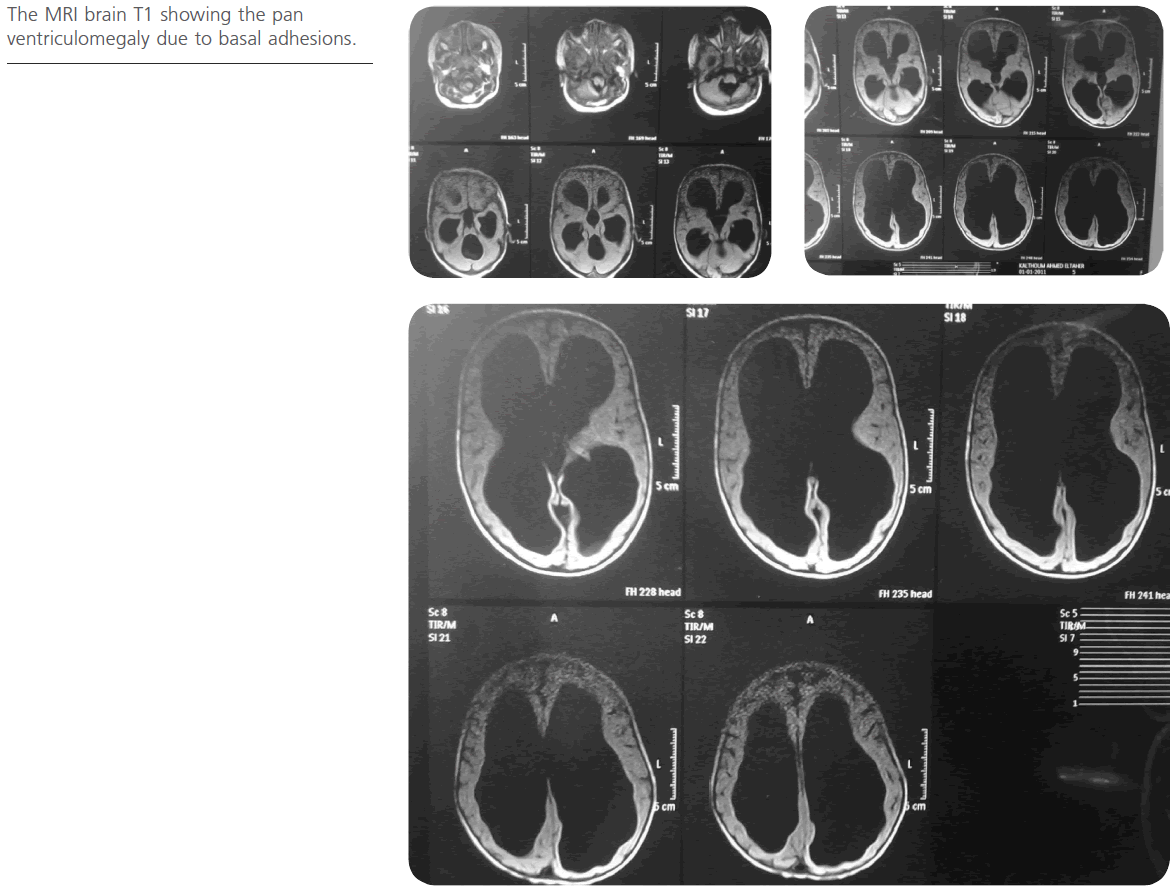 jneuro-basal-adhesions