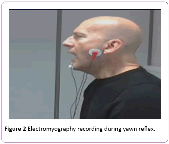jneuro-recording-during-yawn-reflex